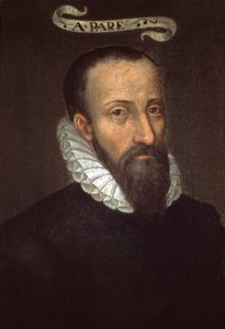 Ambroise Pare. 1500-tallet (maleri) av French School