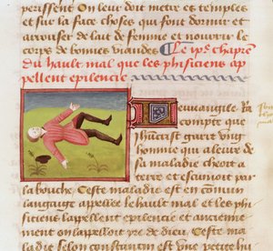 Fru 22532 Pasient som lider av et epileptisk anfall, fra The Book of the Properties of Things av Barthelemy langlais, ca. 1410-15 av French School