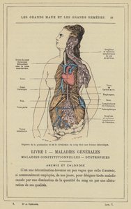 Organer for blodproduksjon og sirkulasjon hos en klorotisk kvinne (farge litho) av French School