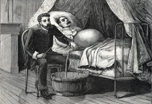 Pasient med avansert levercirrhose, lege som utfører en punktering (gravering) 1888 av French School