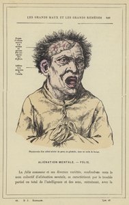Fysiognomi av en romvesen rammet av paral sie generale, i et rasende anfall (farge litho) av French School