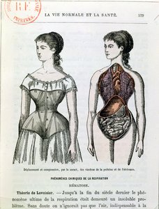 The Harmful Effects of the Corset, illustrasjon fra La Vie Normale et la Sante av Dr Jules Rengade (f.1841) ca. 1880 av French School