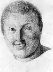En epileptiker, -i "Studium of the physiognomy of alienated people", tegning av Gabriel