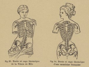 Sammenligning av formen på brystet og brystkassen til Venus de Milo med formen til en fransk sosialist fra slutten av 1800-tallet av German School