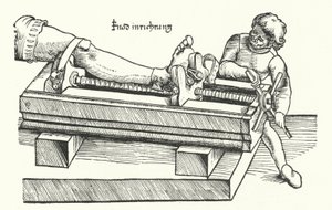 Enhet for å rette ut et såret ben (gravering) av German School