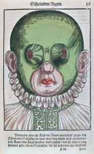 Maske for behandling av strabismus, fra Ophthalmodouleia av Georg Bartisch (1535-1636) utgitt i Dresden i 1583 (farget treblokktrykk) av German School