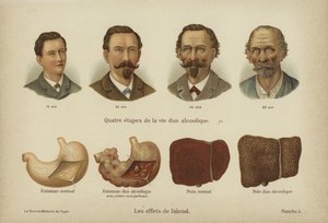 Effektene av alkoholmisbruk (farge litho) av German School