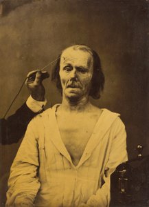 Et avslappet ansikt (til venstre); Dyp oppmerksomhet (til høyre) av Guillaume Benjamin Amant Duchenne