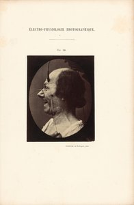  av Guillaume Benjamin Duchenne