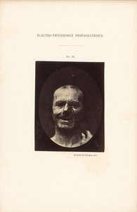 av Guillaume Benjamin Duchenne