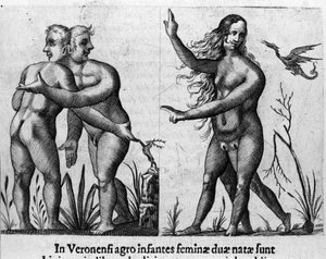 Ulike typer menneskelige monstre: en mann med doble kropper og hoder og en kvinne med fire ben og to kjønn. Gravering fra "De monstrorum natura, causis et differentiis" av Fortunio Liceti (1577-1656), italiensk vitenskapsmann. 1646 av Italian School
