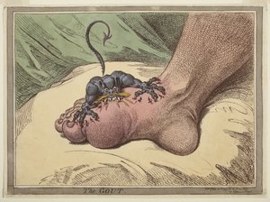 Gikten av James Gillray