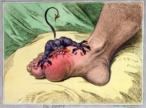 The Gout, utgitt av Hannah Humphrey i 1799 (håndfarget myk grunnetsing)