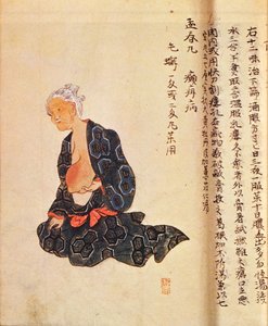 Den første kirurgiske behandlingen av brystkreft utført under generell anestesi av Seishu Hanaoka (1760-1836) i 1804 av Japanese School