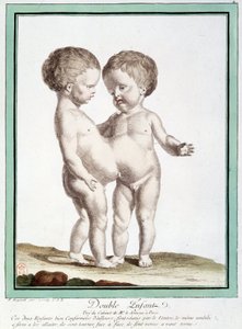 Siamesiske barn - i "" Naturens avvik"" av Régnault av Jean Baptiste Regnault