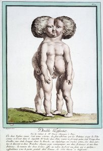 Siamesiske barn - i "" Naturens avvik"" av Régnault av Jean Baptiste Regnault