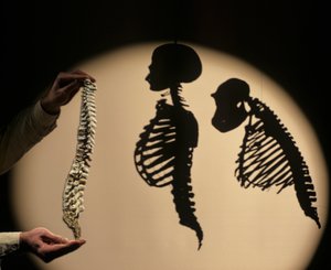 DOH, De første stegene, Ryggmargrekonstruksjon, Bruce Latimer, Cleveland Museum of Natura… av Kenneth Garrett