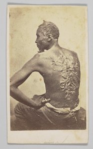 Gordon under medisinsk inspeksjon, 1863. av McPherson and Oliver