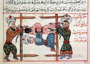 Reduksjon av et brudd. Miniatyr fra en godbit av tyrkisk medisin av Sharaf al-din av Ottoman School
