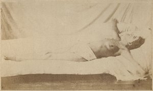 Hysterisk epilepsi, angrep, korsfestelse, plate VI fra 