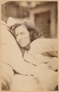 Hysterisk epilepsi, delirium, begjær, plate XXXVI fra 