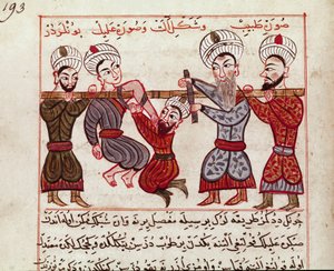 Medisin: ortopedisk intervensjon. Miniatyr tatt fra en melking av tyrkisk medisin av Charaf-ed-din (Charaf ed Din) (1404-1468) etter “” La Surgery Imperiale”” (Ms Sup Turk 693 fol. 193) 1466 Paris, B.N. av Persian School
