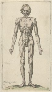 Study of a Nude Man Anatomical Studies (serietittel)