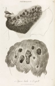Dermatologi Hudsykdommer av John Pardon