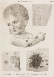 Dermatologi Typer hudsykdom av John Pardon
