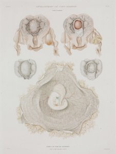 Gynekologi Menneskelig livmor med embryo, ca 1847-1859 av John Pardon