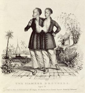 The Siamese Brothers, 18 år, trykt av Charles Hullmandel (1789-1850), ca. 1829