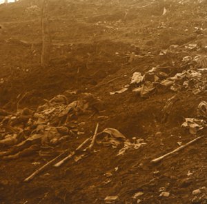 Etter angrepet, Les Éparges, Nord-Frankrike, 1915. av Unbekannt