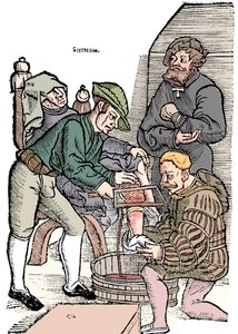 Amputasjon av et ben uten bedøvelse, 1593 av Unbekannt