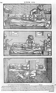Illustrasjon fra Avicenna, 1556 av Unbekannt