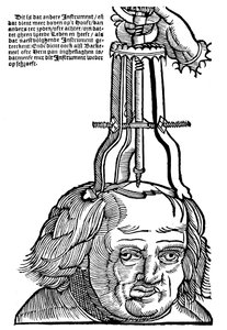 Trephination, 1593 av Unbekannt