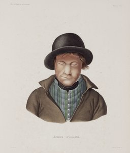 Sykdommer, spedalskhet Spedalsk mann, Island, tidlig på 1800-tallet av Unbekannt