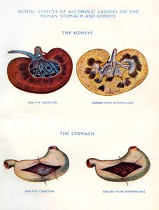 Nieren und Magen durch Alkohol betroffen von Unbekannt