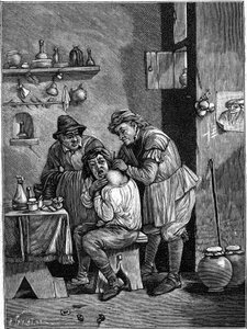 A charlatan surgeon in the 18th century examining a shoulder injury. (From an engraving of time). Engraving in “” La Nature: revue des sciences et de leurs applications aux arts et a l