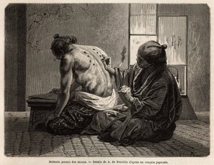 En lege som poserer moxas (små sagebrush-kjegler brent i bestemte deler av kroppen), en forebyggende behandling mot ulike symptomer fra fordøyelsesbesvær til mangel på matlyst, gråt og tannpine, ansetter to ganger i året og har fastsatt tid av japanerne. E av Unknown artist