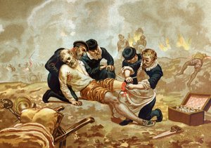 Ambroise Pare Medicin and French surgeon (c. 1509-1590) practices ligation of arteres after amputation. of after hombres y Mujeres celebres. Barcelona 1877. av Unknown artist