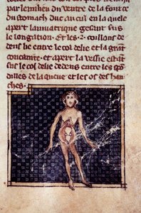 Anatomiske figurer: mannlige og kvinnelige peelinger, åpen buk, som viser nyrene, blæren, kjønnsorganene: detalj av kvinnen. Miniatyr fra manuskriptet "" Surgery" (Folio 29) skrevet av Henri de Mondeville (kirurg ved Philippe Le Bel professor i anatomi) av Unknown artist