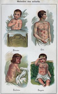 Diseases of children: Hives, Measles, scabies, scarlet fever. In” The new natural medication”” by F.E. Bilz. av Unknown artist