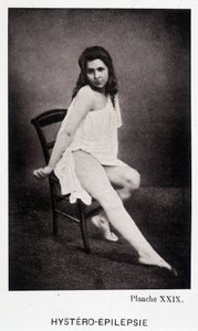 Hystero Epilepsie - Contracture in "" Fotografisk ikonografi av Salpétrière: service of Mr. Charcot" av Paul Regnard og Bourneville av Unknown artist