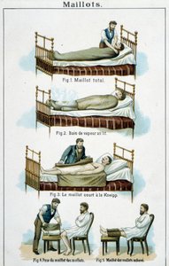 Trøyer: 1) Totalt jersey, 2) Dampbad i sengen, 3) Kneipp kort jersey, 4-5) Kalv jersey - i "Bilz, Natural Medication", slutten av 1800-tallet av Unknown artist