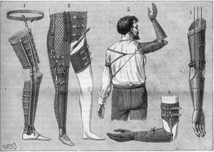 Modern apparatus for amputes. 1) artificial leg with belt, 2) apparatus for desarticules the thigh, 3 and 4 arificial arms invented and built by M.L Matthieu for the late Roger, 5) artificial arm with hand, thumb and index finger. in “La nature” of 1888. av Unknown artist