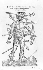Alle slags traumatiske krigsskader. Det 16. århundre av Unknown artist