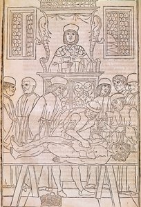 Autopsi. Kodice. Kroppen til en død person dissekeres av leger for en anatomistudie. “” Fascicula Medicinae””. Kodeks av en leges fascikel av Johannes Kethan av Unknown artist
