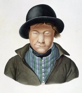 Spedalske av Island, rundt 1840, B.N. av Unknown artist
