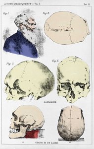 Studie om morfologien til en delinquant hodeskalle av den italienske kriminologen av Unknown artist