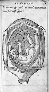 Posisjonen til fosteret i livmoren under graviditet. Gravering fra "" De la generation des enfants"" av den franske legen og kirurgen Ambroise Pare (1509-1590) 1500-tallet av Unknown artist